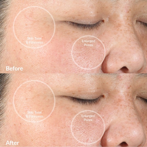 NIB PDM Clean - Picture 6 of 8